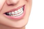 Как выбрать хорошего ортодонта?